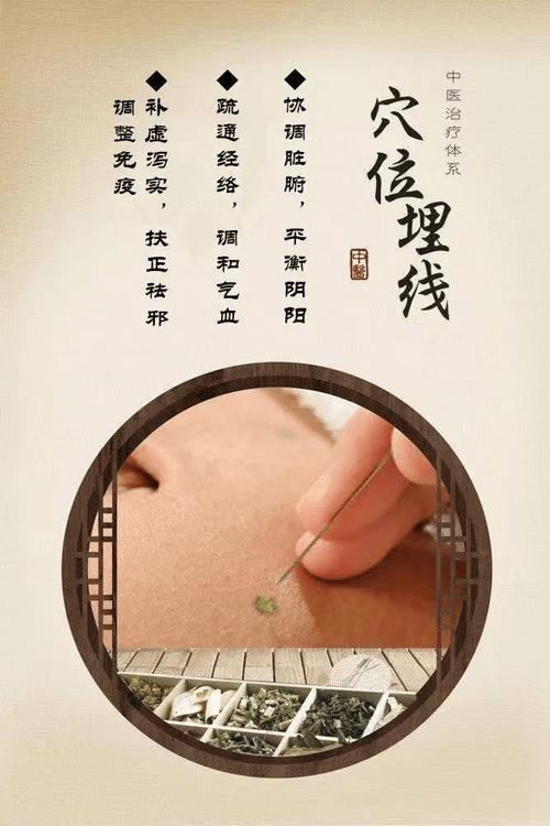 埋线针灸起到什么作用