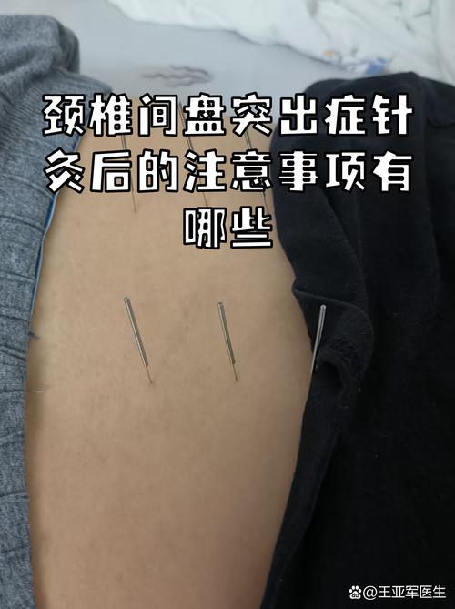颈椎增生针灸能治好吗