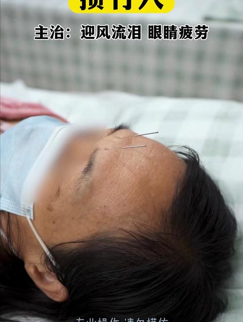 针灸后眼睛看东西模糊