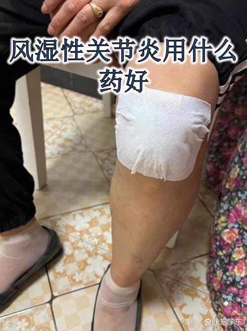 痛风治疗重庆九五直选