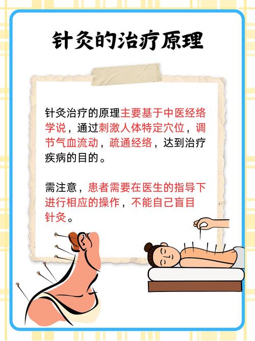 针灸治疗骨质增生方法