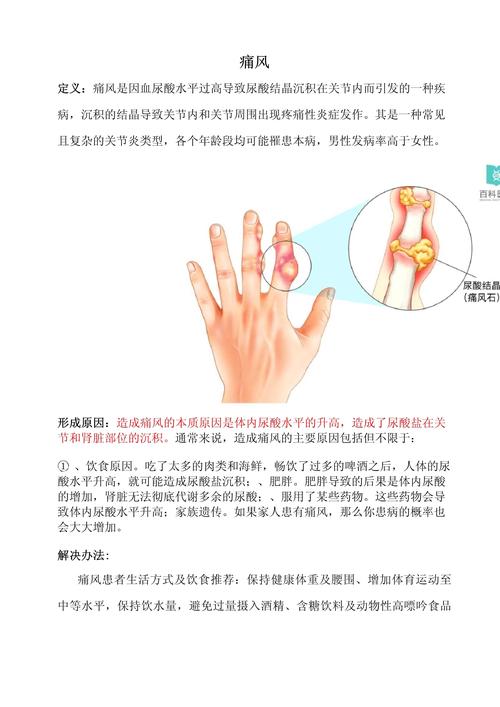痛风病治疗方法哪种好