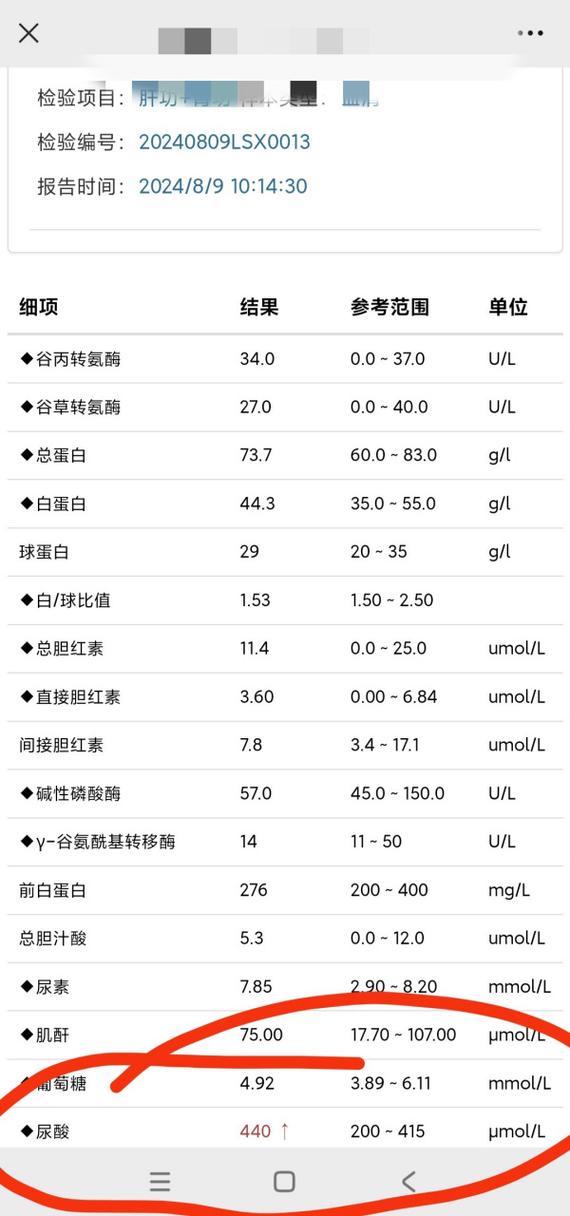 痛风性肾病 诊断标准