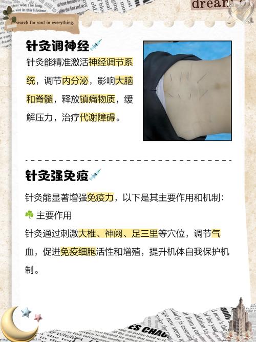 针灸生男孩原理是什么