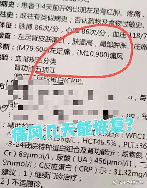 痛风犯了一般几天能好