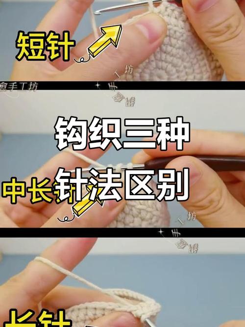 针灸长针和短针的区别