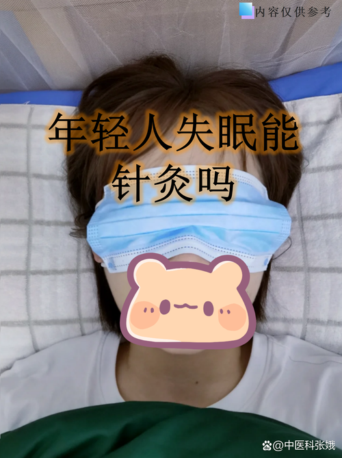 扎针灸可以治疗失眠吗