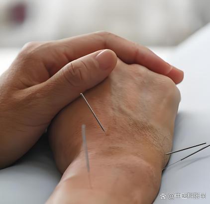 脾虚吃中药还是打针灸