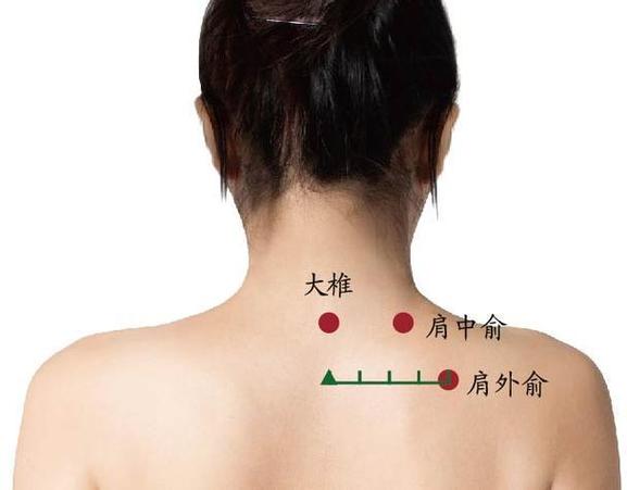 肩周炎针灸位置示意图