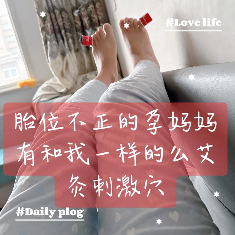 孕妇可以做针灸理疗吗