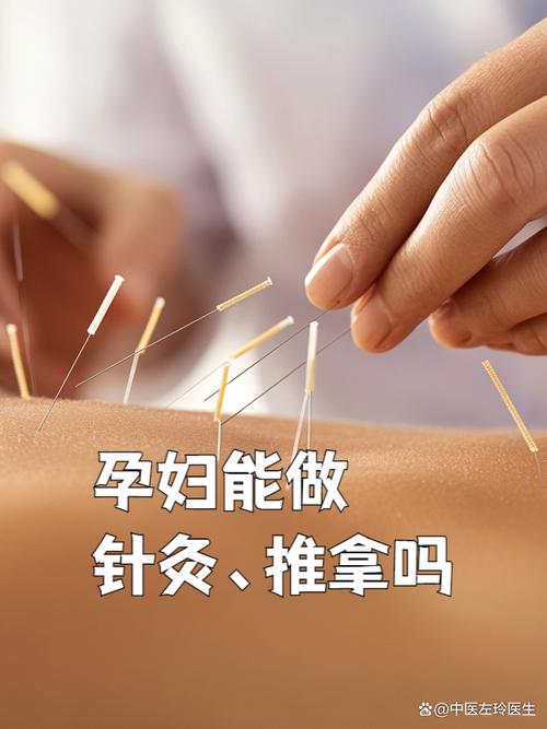 孕妇可以做针灸理疗吗