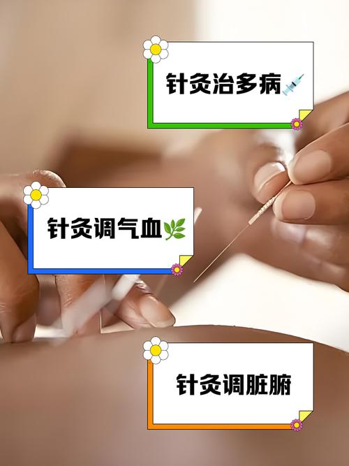 针灸治疗咽炎几天能好