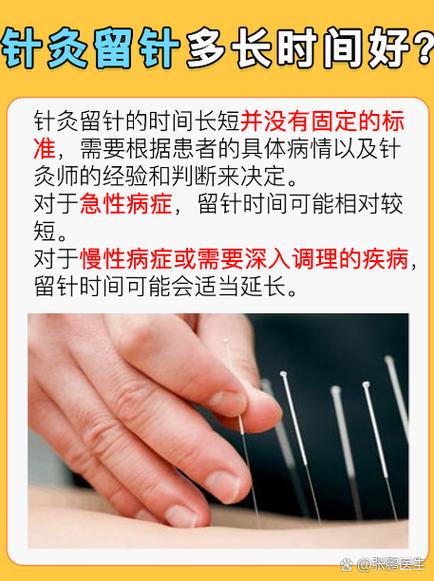 针灸留针时间多久合适