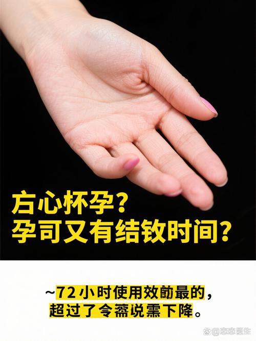 安全期吃金毓婷有用吗