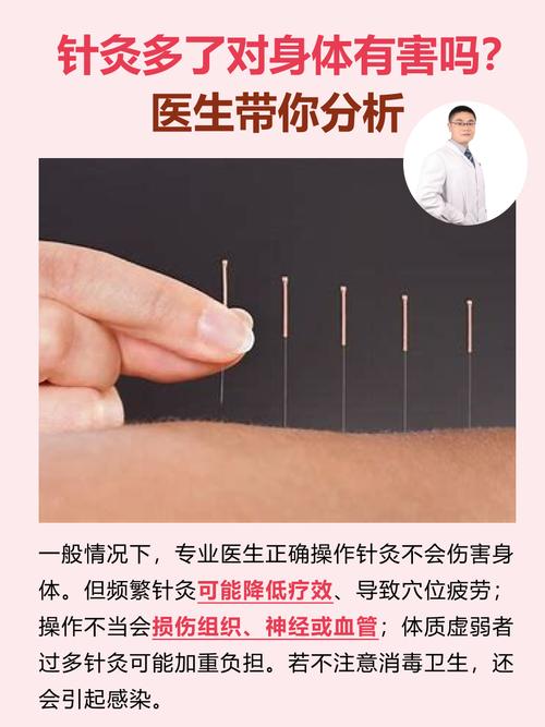 连续针灸对身体有害吗