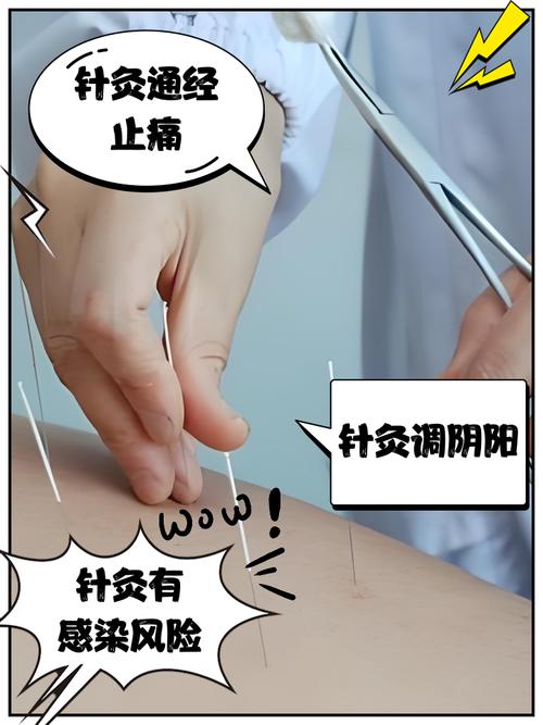 连续针灸对身体有害吗