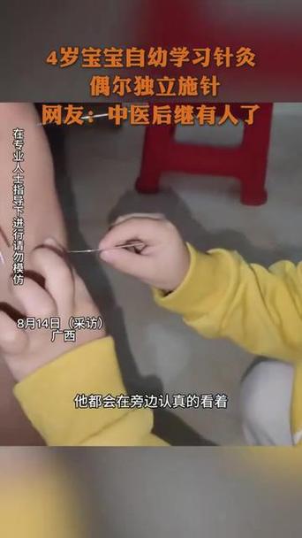 宝宝针灸有什么副作用