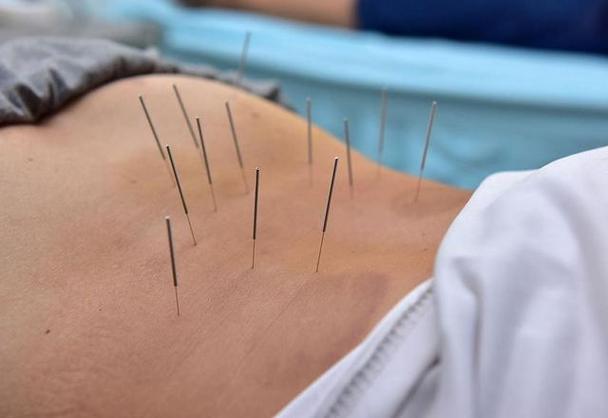 腰肌劳损针灸后更严重