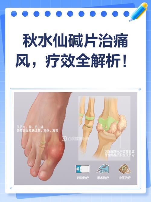 秋水仙碱能治疗痛风吗