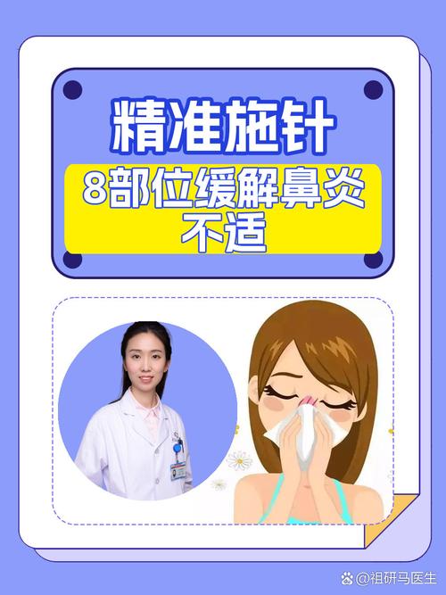 针灸鼻炎怎么治疗方法