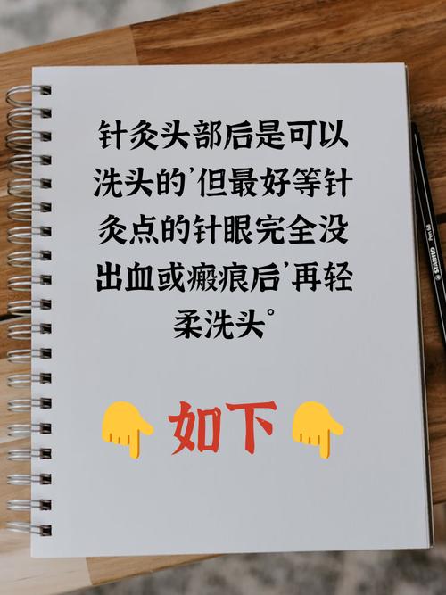 针灸头部后几天能洗头