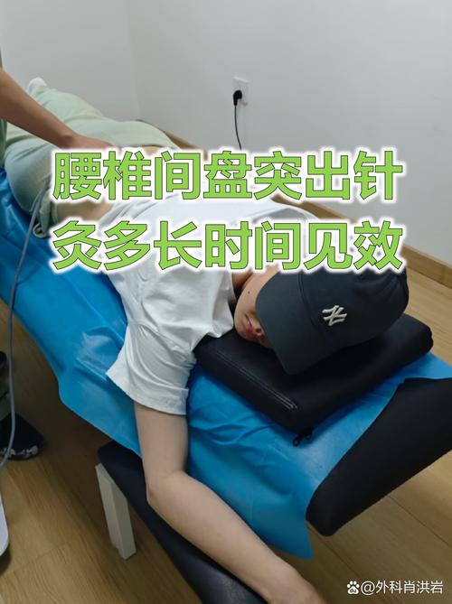 腰肌劳损针灸多久会好