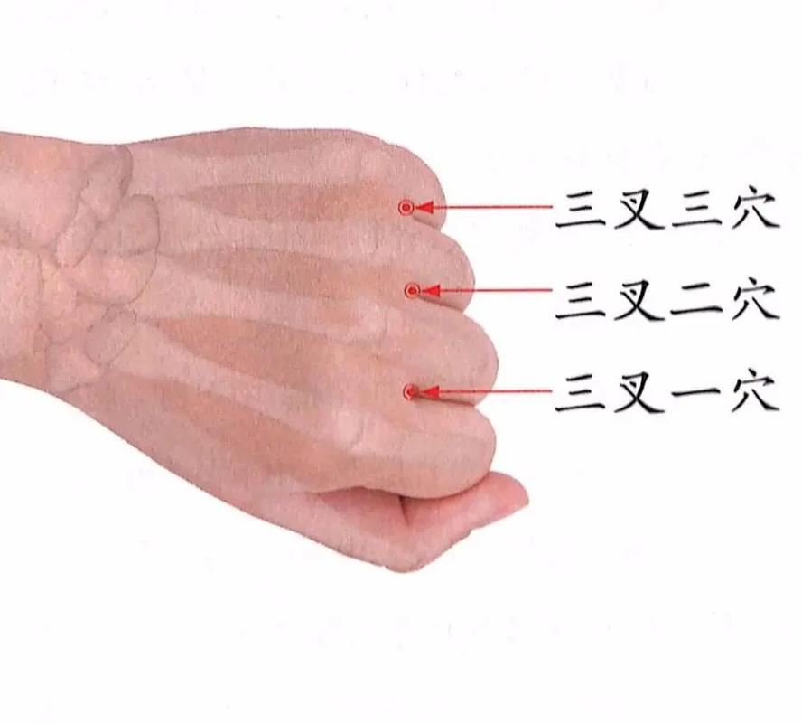 针灸治肩周炎效果咋样