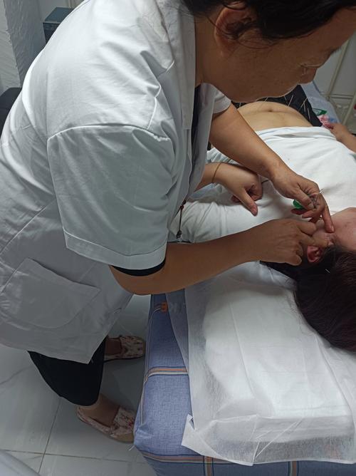 女性针灸视频大全视频