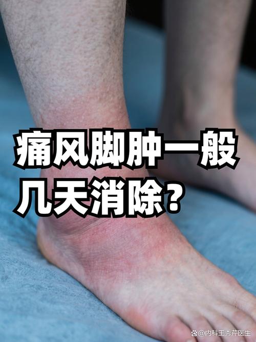 痛风会引起糖尿病足吗