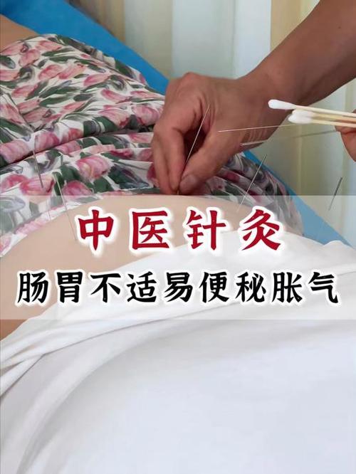 针灸可以治疗哪些胃病