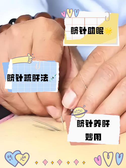 孕妇不能针灸哪些部位