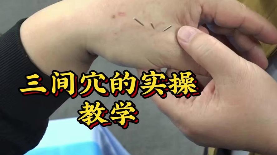 中医针灸视频教学视频