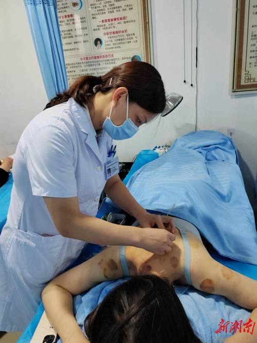 中医院针灸科看什么病