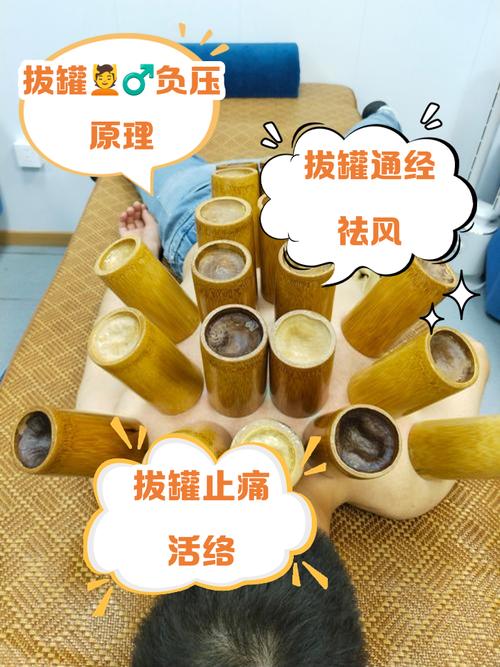 针灸和拔罐能同时做吗