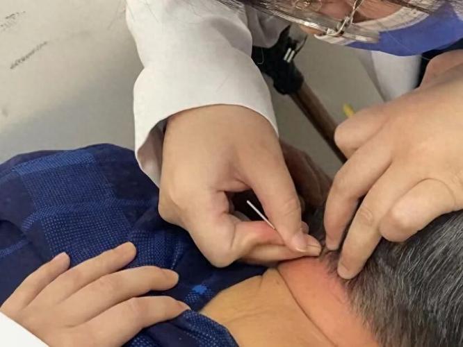 扎针灸反而睡不着觉了