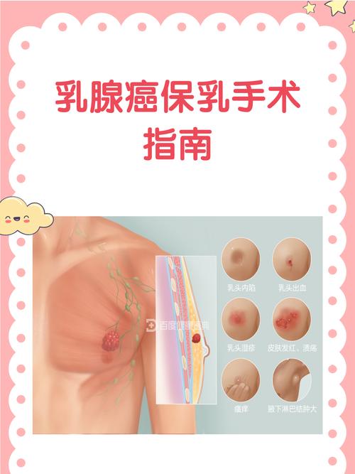 乳腺癌保乳手术安全吗