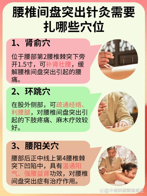 腰突针灸要针多久能好