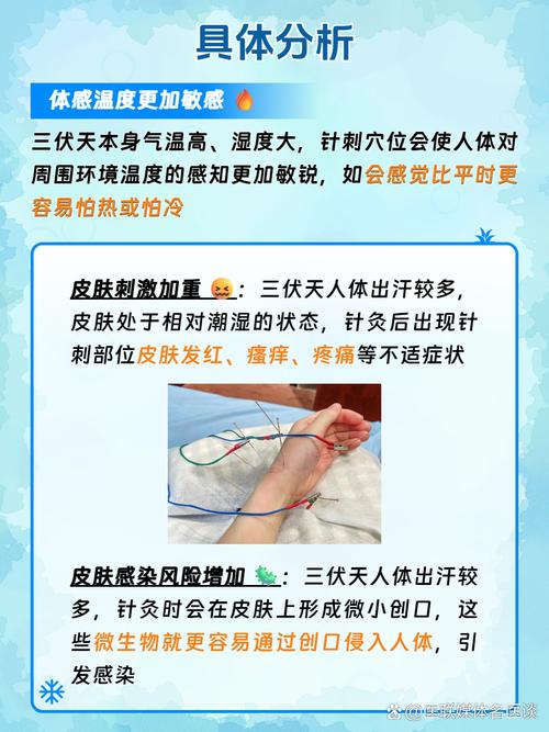 腰突针灸要针多久能好