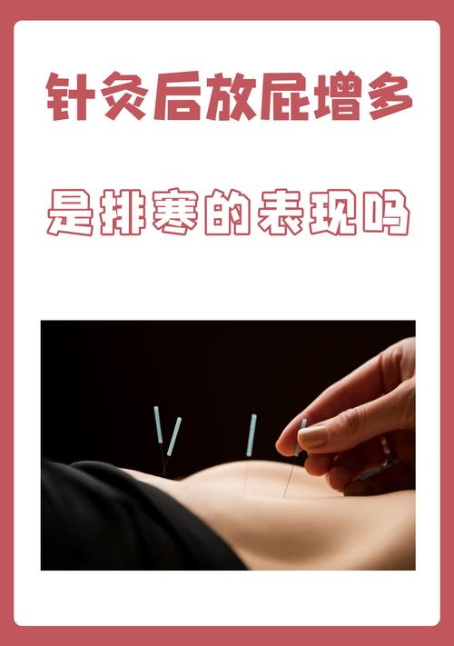 为什么针灸后一直放屁