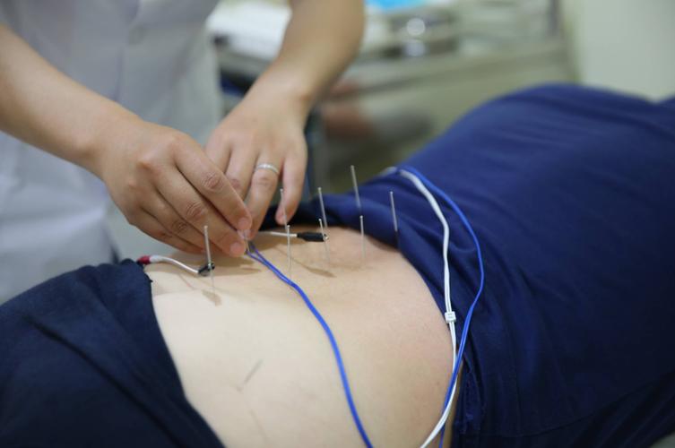 为什么针灸后一直放屁