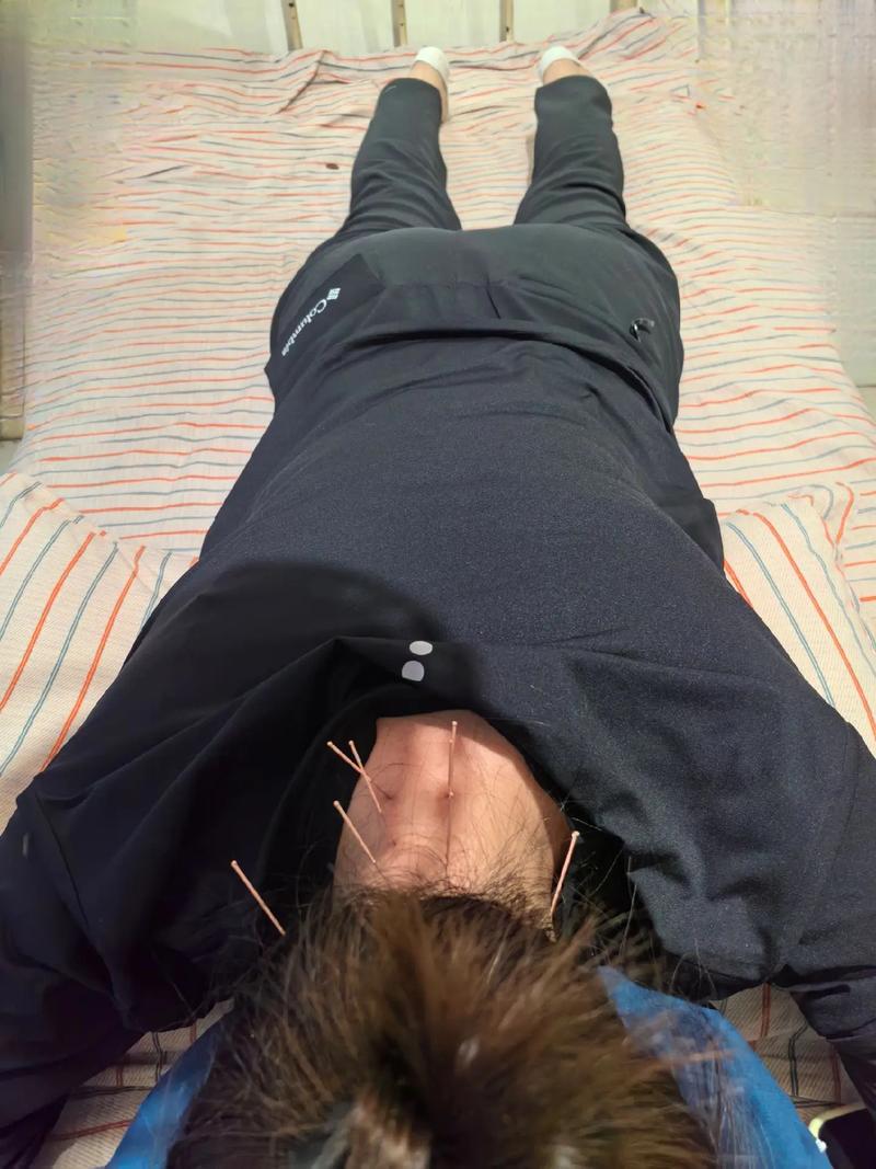 胡超伟讲针灸全集视频