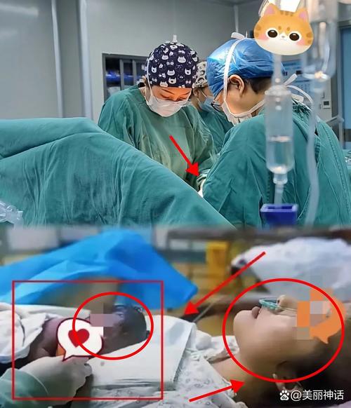 刨腹产小孩没有安全感