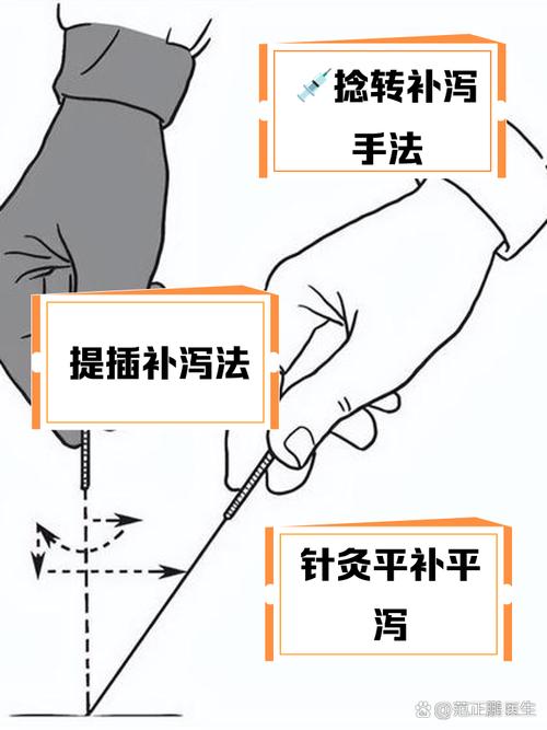 针灸的补法和泻法视频