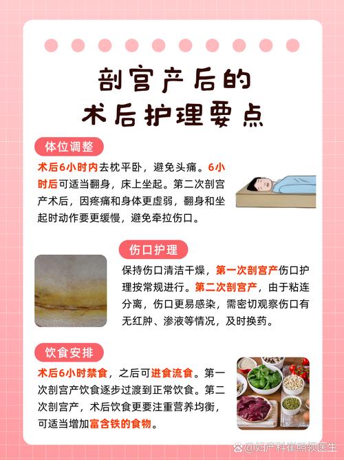 剖腹产私立医院安全吗