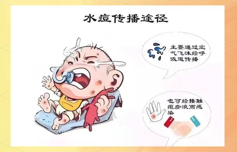幼儿预防水痘安全教育