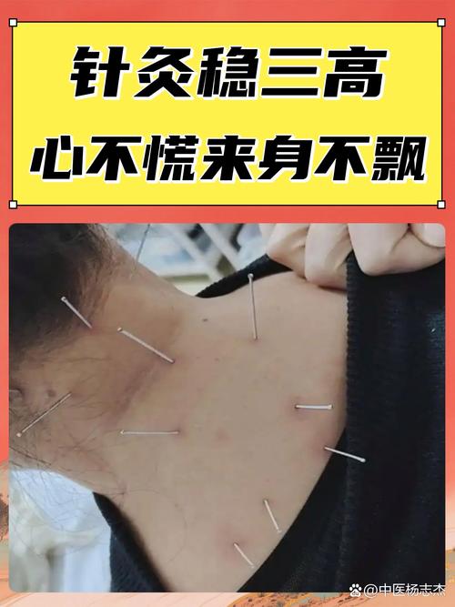 针灸能够治疗腰突症吗