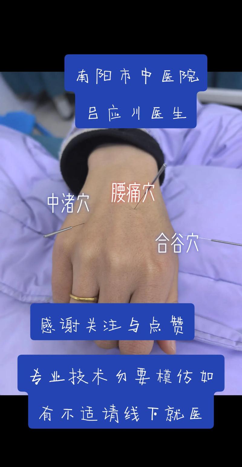 针灸能够治疗腰突症吗