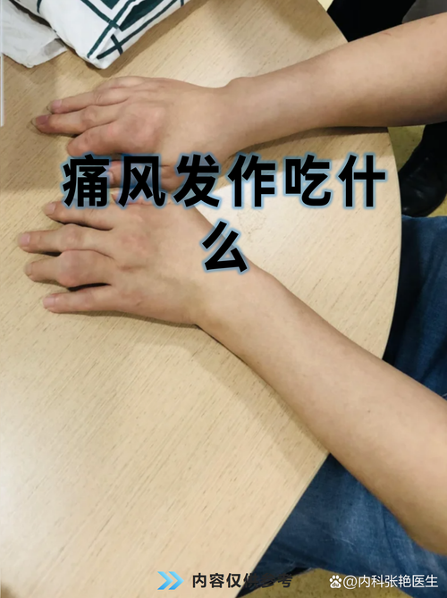 急性痛风发作吃安康信