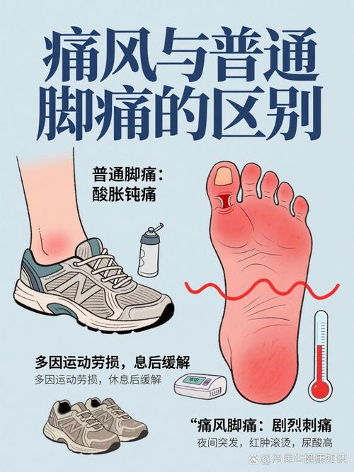 脚痛怎么看是不是痛风