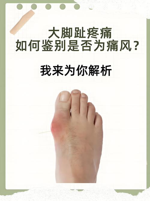 为什么女生不容易痛风